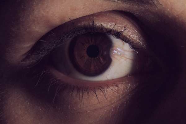Pterigium nədir?