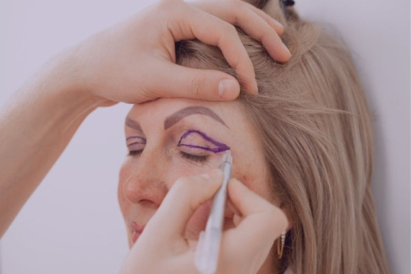 Blefaroplastika Nədir və Kimlər Üçün Uyğundur?